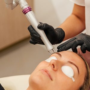 Refresh your skin with CO2 Laser - 1