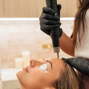 picosure laser treatment