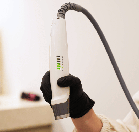lasergenesistreatments-img1