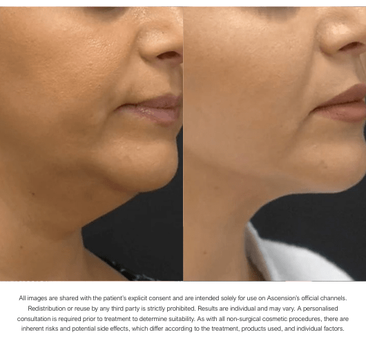 bodycontouringtreatments-img